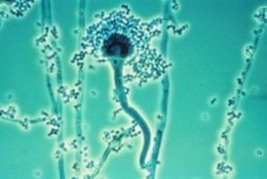 Aspergillus fumigatus Aspergillus fumigatus