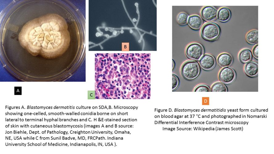 Blastomyces dermatitidis Blastomyces dermatitidis