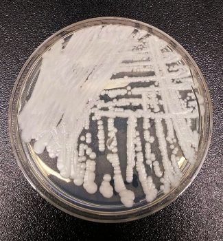Candida auris Candida auris