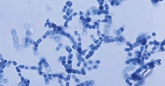 Coccidioides immitis Coccidioides immitis