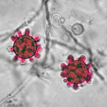 Histoplasma capsulatum Histoplasma capsulatum