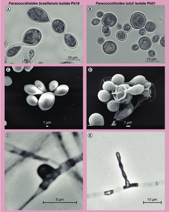Paracoccidioides brasiliensis Paracoccidioides brasiliensis