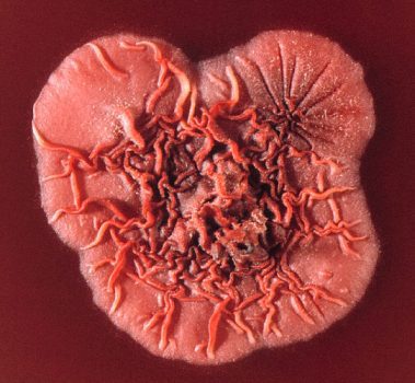 Talaromyces marneffei Talaromyces marneffei